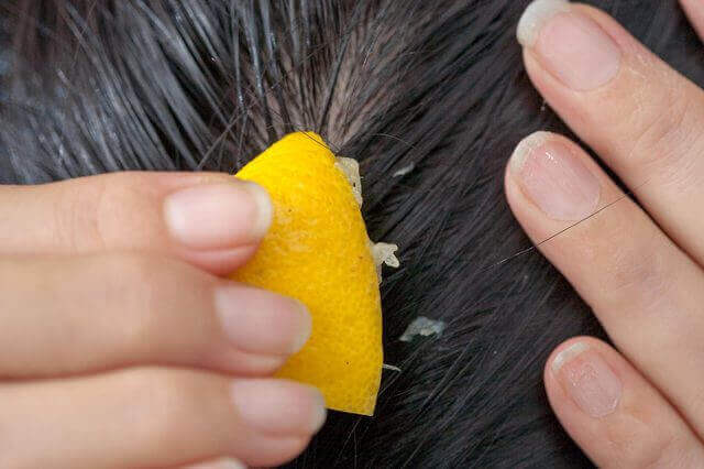предотвратить выпадение волос с помощью лимонного сока