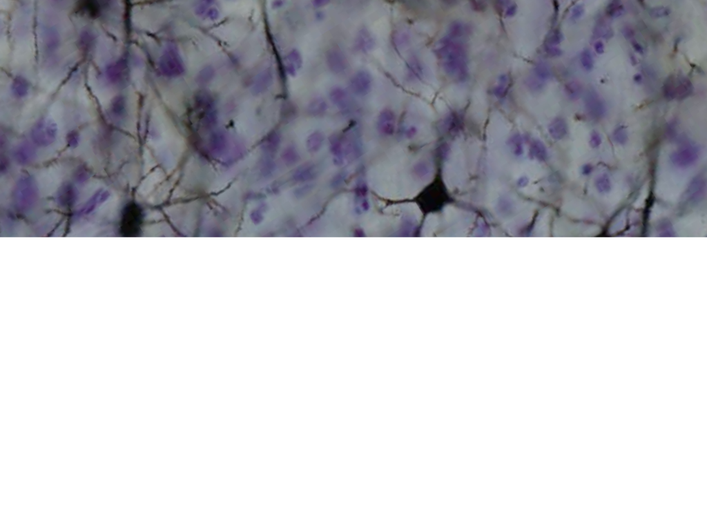 Нейроны коры головного мозга, окрашенные методом Гольджи
