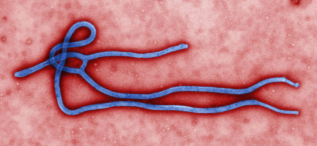 Цветная передача электронно-микроскопического изображения вируса Эбола и его отдельных ультраструктур