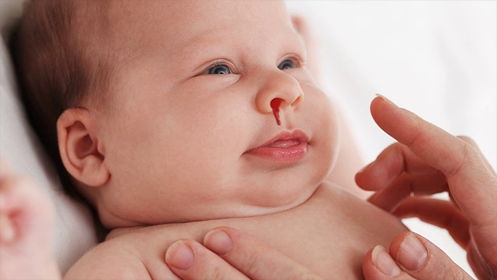 кровь из носа у младенца