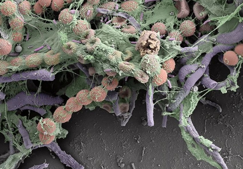 Микроскопический взгляд на слизистую оболочку бактерий
