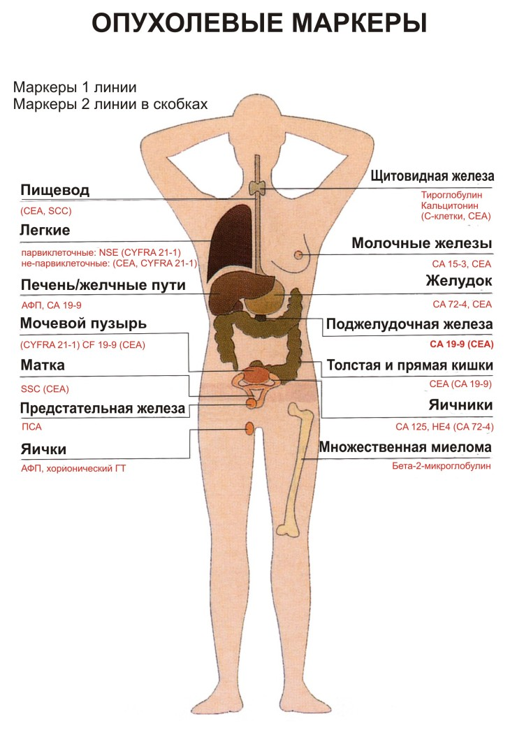 Опухолевые маркеры инфографика
