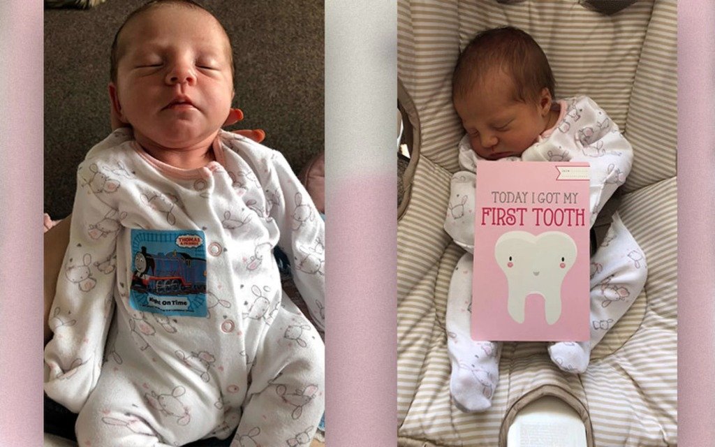 У Исла-Роуз Хейсман выдернули первый зуб, когда ей было всего 12 дней.