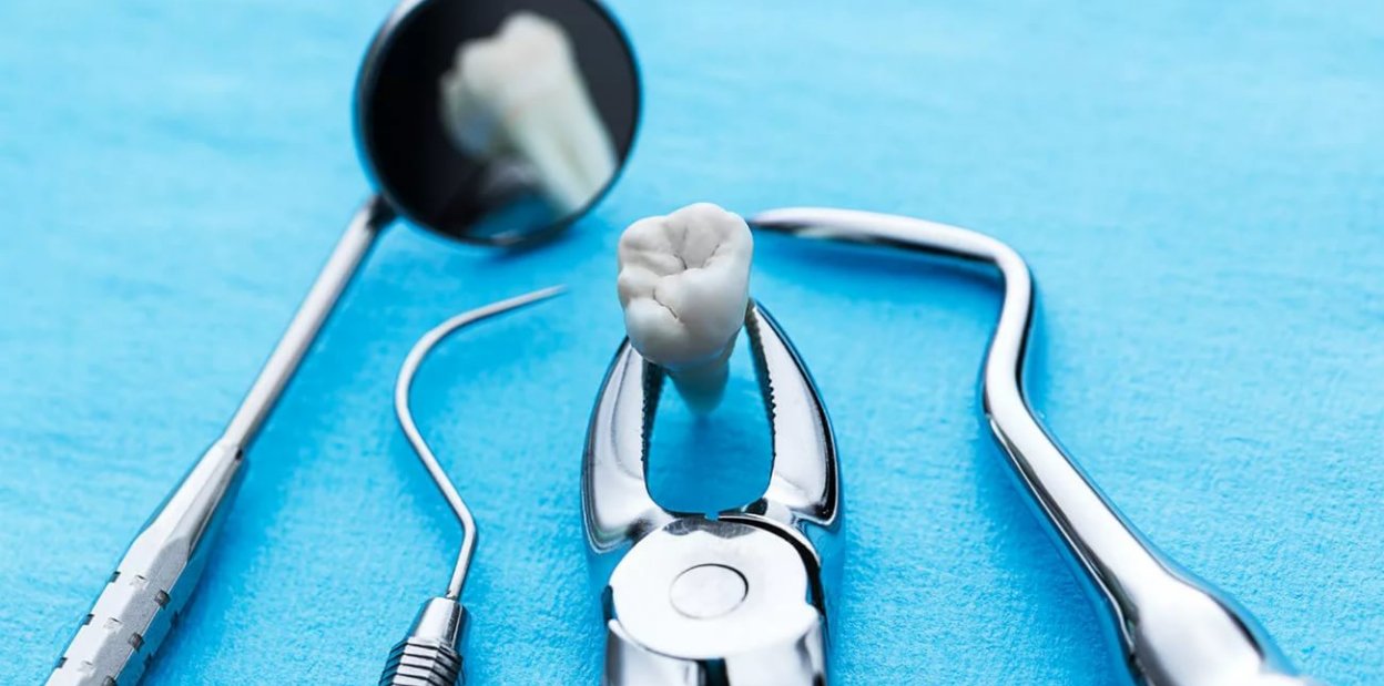 Показания и противопоказания при удалении зуба