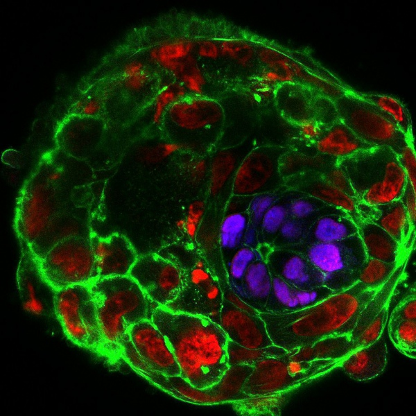 Десятидневный эмбрион человека. Фото University of Cambridge / The Guardian 