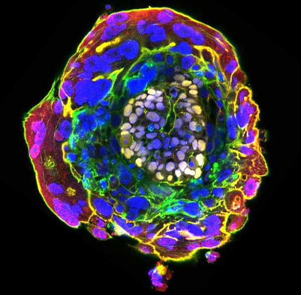 Человеческий эмбрион на одиннадцатом день развития. Фото University of Cambridge / The Guardian