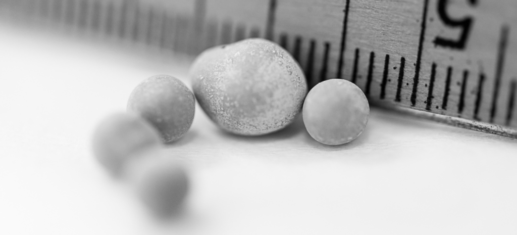 размеры камней в почках