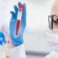 Биохимический анализ крови: для кого и как проводится?